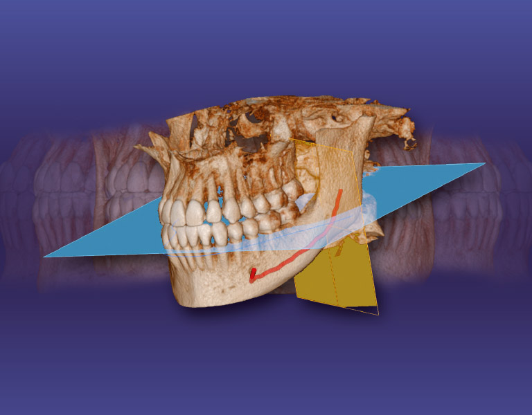 DVT 3D-Ansicht Dres. Fechtig & Kollegen