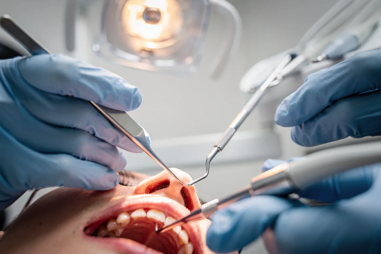 Zahnarzt führt präzise Behandlung mit Instrumenten im Mund des Patienten durch