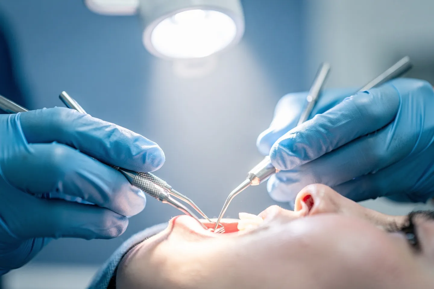 Ein Zahnarzt führt eine präzise Behandlung mit metallischen Instrumenten aus