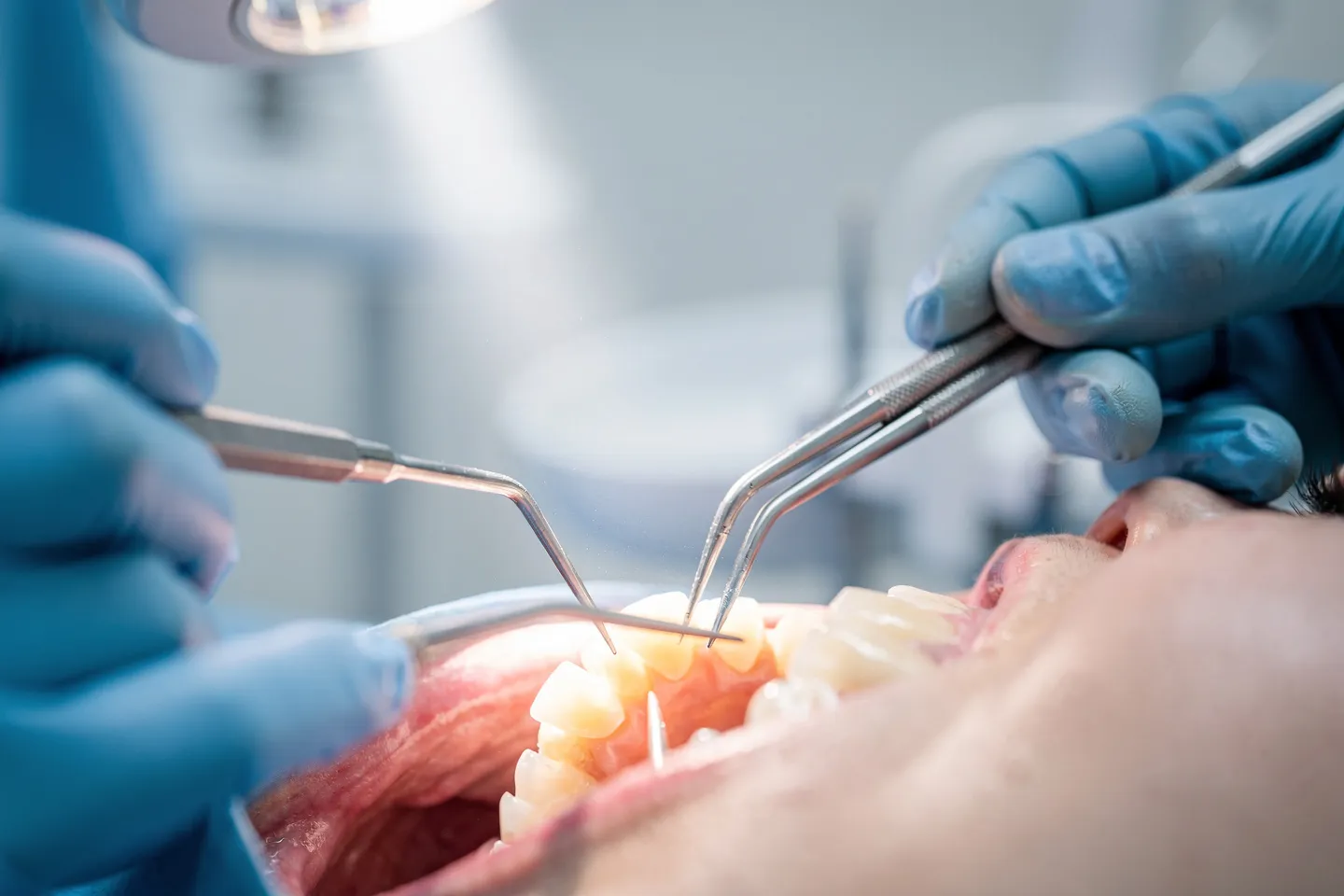 Zahnarzt führt präzise Behandlung mit metallischen Instrumenten unter hellem Licht durch