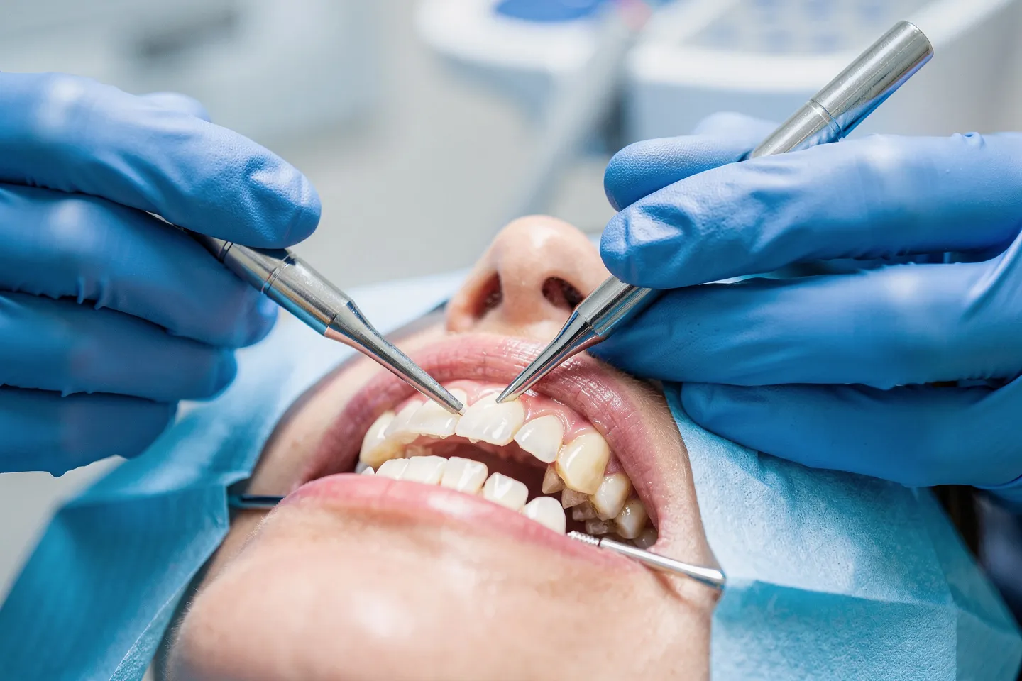 Zahnarzt führt präzise Behandlung mit Instrumenten an Patienten durch