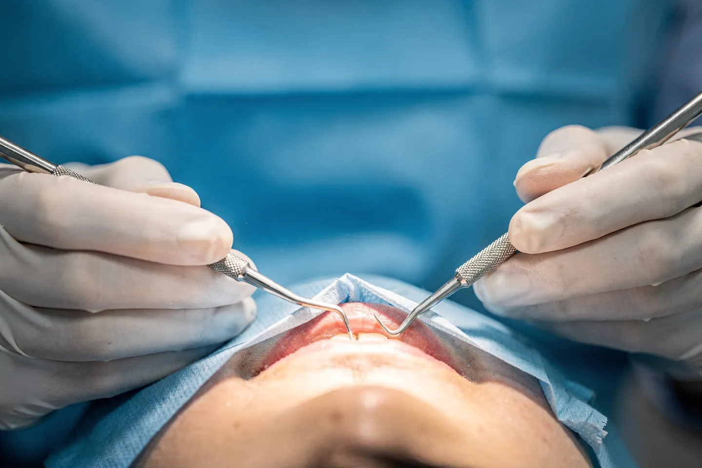 Zahnarzt führt präzise Behandlung mit Instrumenten unter hellem OP-Licht durch